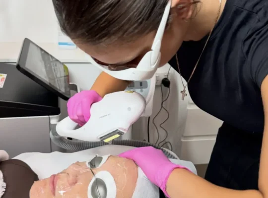 ipl skin rejuvenation benefits