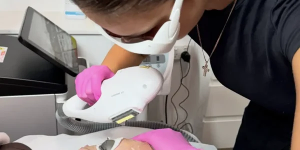 ipl skin rejuvenation benefits