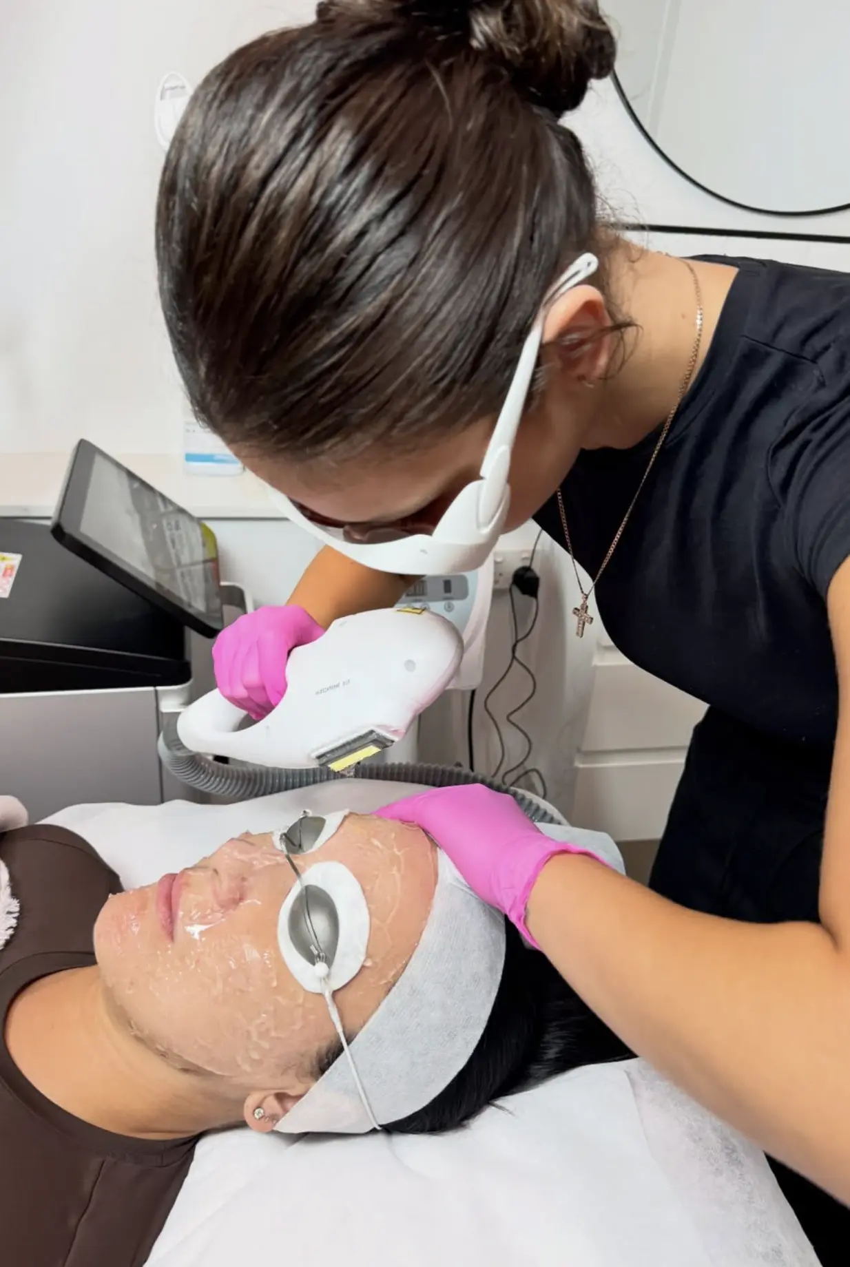 ipl skin rejuvenation benefits